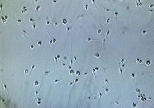 El alarmante descenso de la calidad del semen en España que está afectando la fertilidad masculina | VinylStation Radio
