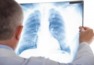 El alarmante resurgimiento de la silicosis en España que está sorprendiendo a todos | VinylStation Radio
