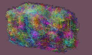 El descubrimiento de un milímetro cúbico de cerebro que podría revolucionar la medicina ¿estás preparado para lo que viene? | VinylStation Radio