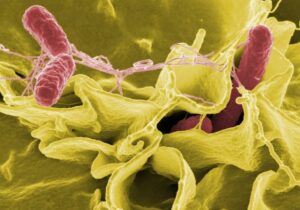 El prometedor trasplante fecal y el error que lo cambia todo