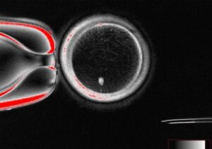 ¿Es posible crear vida con células de la piel? | VinylStation Radio