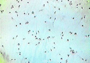 Qué hizo esta IA para lograr lo imposible en fertilidad | VinylStation Radio